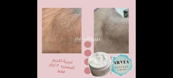 أعشاب طبيعيه - 8