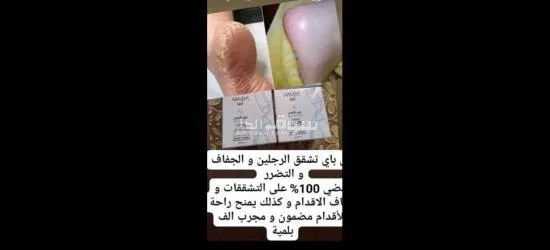 أعشاب طبيعيه - 16